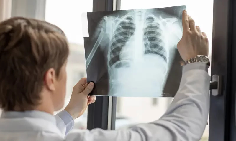 Teleradiologia – kompleksowe rozwiązania i nowoczesna diagnostyka dla placówek medycznych